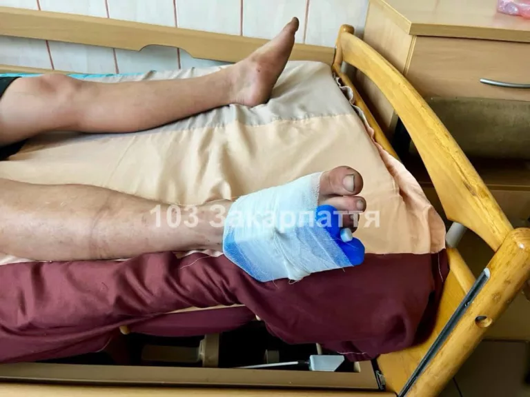 Mérgeskígyó mart meg egy 21 éves férfit Kárpátalján
